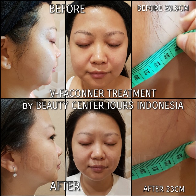 Beauty Treatment